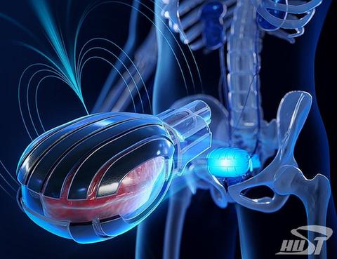 光电信息学院臧剑锋教授团队在磁机器人膀胱研究方向取得新进展